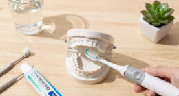 The Electric Pain In Her Tooth Baffled Every Dentist. What Was Wrong?
